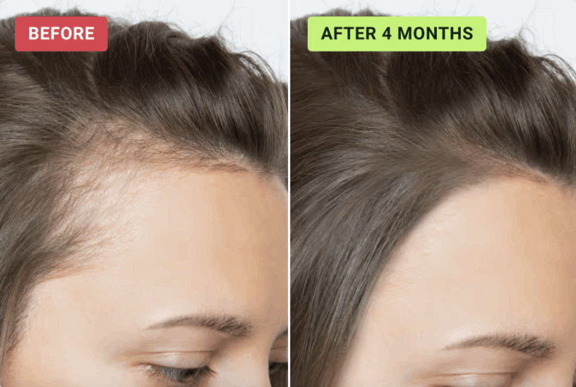 halogrow customer review jessica