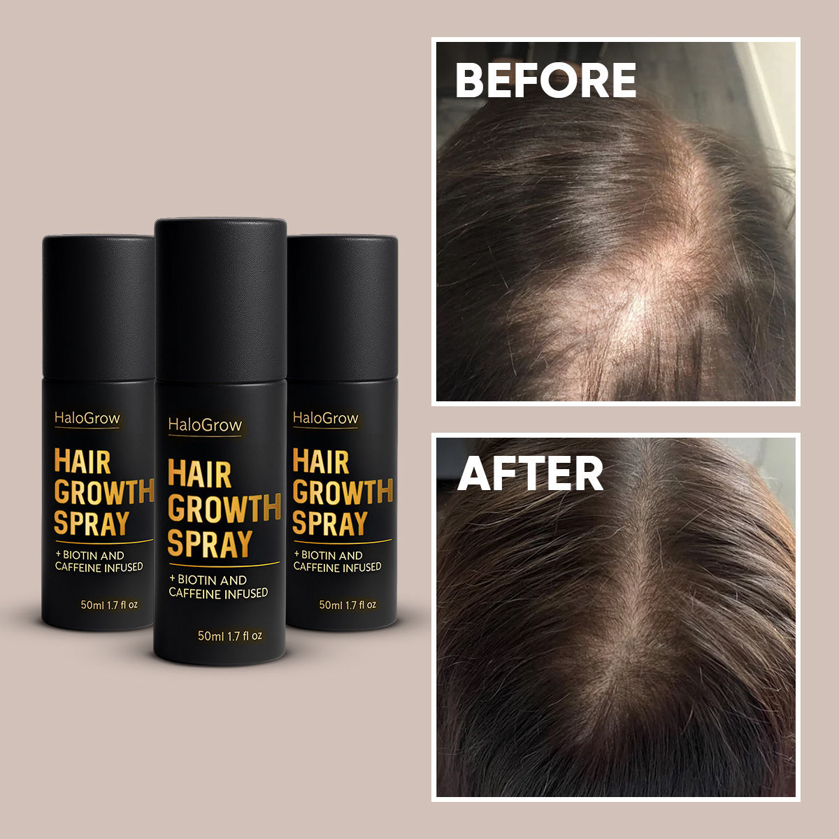 halogrow benefits before after image